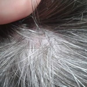 cabelo grisalho