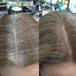 CABELO BRANCO ANTES E DEPOIS